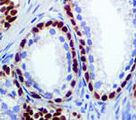 RABEPK / p40 Antibody - IHC of p40 on FFPE Prostate tissue.