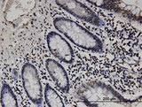 RABGAP1L Antibody - Immunoperoxidase of monoclonal antibody to RABGAP1L on formalin-fixed paraffin-embedded human small Intestine. [antibody concentration 3 ug/ml]