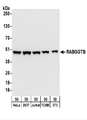 RABGGTB Antibody - Detection of Human and Mouse RABGGTB by Western Blot. Samples: Whole cell lysate (50 ug) from HeLa, 293T, Jurkat, mouse TCMK-1, and mouse NIH3T3 cells. Antibodies: Affinity purified rabbit anti-RABGGTB antibody used for WB at 0.1 ug/ml. Detection: Chemiluminescence with an exposure time of 30 seconds.