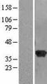 RABGGTB Protein - Western validation with an anti-DDK antibody * L: Control HEK293 lysate R: Over-expression lysate