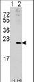 RAC1 Antibody - Western blot of RAC1 (arrow) using rabbit polyclonal RAC1 Antibody (S71). 293 cell lysates (2 ug/lane) either nontransfected (Lane 1) or transiently transfected with the RAC1 gene (Lane 2) (Origene Technologies).