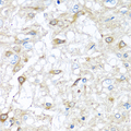 RAC2 Antibody - Immunohistochemistry of paraffin-embedded rat brain using RAC2 antibodyat dilution of 1:100 (40x lens).