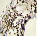 RACGAP1 / MGCRACGAP Antibody - RACGAP1 Antibody immunohistochemistry of formalin-fixed and paraffin-embedded human testis tissue followed by peroxidase-conjugated secondary antibody and DAB staining.