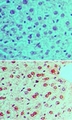 RAD17 Antibody - IHC of phosphorylated Rad17 in formalin-fixed, paraffin-embedded mouse liver tissue using an isotype control (top) and Peptide-affinity Purified Polyclonal Antibody to RAD17 (Phospho Ser645) (bottom) at 5 ug/ml.