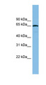 RAD18 Antibody - RAD18 antibody Western blot of COLO205 cell lysate. This image was taken for the unconjugated form of this product. Other forms have not been tested.