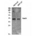 RAD51 / RECA Antibody - Western blot of Rad51 antibody