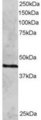 RAD51C Antibody - RAD51C antibody staining (2 ug/ml) of HeLa lysate (RIPA buffer, 30g total protein per lane). Primary incubated for 12 hour. Detected by Western blot of chemiluminescence.