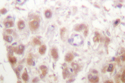 RAD52 Antibody - IHC of Rad52 (N99) pAb in paraffin-embedded human testis tissue.