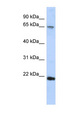 RAD54B Antibody - RAD54B antibody Western blot of HepG2 cell lysate. This image was taken for the unconjugated form of this product. Other forms have not been tested.