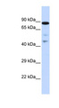 RAD54L Antibody - RAD54L / RAD54 antibody Western blot of Placenta lysate. This image was taken for the unconjugated form of this product. Other forms have not been tested.