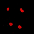 RAD54L2 Antibody - Immunofluorescent analysis of RAD54L2 staining in MCF7 cells. Formalin-fixed cells were permeabilized with 0.1% Triton X-100 in TBS for 5-10 minutes and blocked with 3% BSA-PBS for 30 minutes at room temperature. Cells were probed with the primary antibody in 3% BSA-PBS and incubated overnight at 4 deg C in a humidified chamber. Cells were washed with PBST and incubated with a DyLight 594-conjugated secondary antibody (red) in PBS at room temperature in the dark.