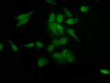 RAD54L2 Antibody - Immunofluorescence staining of Hela cells at a dilution of 1:200, counter-stained with DAPI. The cells were fixed in 4% formaldehyde, permeabilized using 0.2% Triton X-100 and blocked in 10% normal Goat Serum. The cells were then incubated with the antibody overnight at 4 °C.The secondary antibody was Alexa Fluor 488-congugated AffiniPure Goat Anti-Rabbit IgG (H+L) .
