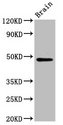 RAD9B Antibody - Positive Western Blot detected in Mouse brain tissue. All lanes: RAD9B antibody at 6 µg/ml Secondary Goat polyclonal to rabbit IgG at 1/50000 dilution. Predicted band size: 48, 47, 39, 29, 30 KDa. Observed band size: 48 KDa