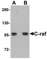 RAF1 / RAF Antibody - Western blot analysis of C-raf in 3T3 cell lysate with C-raf antibody at (A) 0.5 and (B) 1 ug/ml.