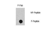 RAF1 / RAF Antibody - Dot blot of Phospho-RAF1-S471 polyclonal antibody on nitrocellulose membrane. 50ng of Phospho-peptide or Non Phospho-peptide per dot were adsorbed. Antibody working concentration was 0.5ug per ml. P-antibody: phospho-antibody; P-Peptide: phospho-peptide; NP-Peptide: non-phospho-peptide.