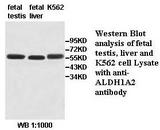 RALDH2 / ALDH1A2 Antibody
