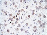 RALY Antibody - RALY antibody ARP34074_P050-NP_031393-RALY Antibody was used in IHC to stain formalin-fixed, paraffin-embedded human brain.  This image was taken for the unconjugated form of this product. Other forms have not been tested.