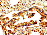 RAMP2 Antibody - Immunohistochemistry image at a dilution of 1:500 and staining in paraffin-embedded human lung tissue performed on a Leica BondTM system. After dewaxing and hydration, antigen retrieval was mediated by high pressure in a citrate buffer (pH 6.0) . Section was blocked with 10% normal goat serum 30min at RT. Then primary antibody (1% BSA) was incubated at 4 °C overnight. The primary is detected by a biotinylated secondary antibody and visualized using an HRP conjugated SP system.