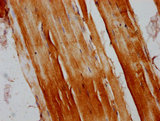 RANBP10 Antibody - Immunohistochemistry Dilution at 1:200 and staining in paraffin-embedded human skeletal muscle tissue performed on a Leica BondTM system. After dewaxing and hydration, antigen retrieval was mediated by high pressure in a citrate buffer (pH 6.0). Section was blocked with 10% normal Goat serum 30min at RT. Then primary antibody (1% BSA) was incubated at 4°C overnight. The primary is detected by a biotinylated Secondary antibody and visualized using an HRP conjugated SP system.