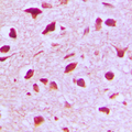 RANBP6 Antibody - Immunohistochemical analysis of RANBP6 staining in human brain formalin fixed paraffin embedded tissue section. The section was pre-treated using heat mediated antigen retrieval with sodium citrate buffer (pH 6.0). The section was then incubated with the antibody at room temperature and detected using an HRP conjugated compact polymer system. DAB was used as the chromogen. The section was then counterstained with hematoxylin and mounted with DPX.