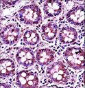 RANGAP1 Antibody - RANGAP1 Antibody immunohistochemistry of formalin-fixed and paraffin-embedded human colon tissue followed by peroxidase-conjugated secondary antibody and DAB staining.