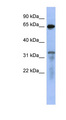 RAP1GAP Antibody - RAP1GAP antibody Western blot of 293T cell lysate. This image was taken for the unconjugated form of this product. Other forms have not been tested.