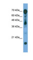 RAP1GAP Antibody - RAP1GAP antibody Western blot of Transfected 293T cell lysate. This image was taken for the unconjugated form of this product. Other forms have not been tested.