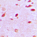 RAP1GAP Antibody - Immunohistochemical analysis of RAP1GAP staining in human brain formalin fixed paraffin embedded tissue section. The section was pre-treated using heat mediated antigen retrieval with sodium citrate buffer (pH 6.0). The section was then incubated with the antibody at room temperature and detected using an HRP conjugated compact polymer system. DAB was used as the chromogen. The section was then counterstained with hematoxylin and mounted with DPX.