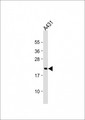 RAP2 Antibody - Anti-RAP2A Antibody (C-Term) at 1:2000 dilution + A431 whole cell lysate Lysates/proteins at 20 ug per lane. Secondary Goat Anti-Rabbit IgG, (H+L), Peroxidase conjugated at 1:10000 dilution. Predicted band size: 21 kDa. Blocking/Dilution buffer: 5% NFDM/TBST.