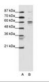 RAP74 / GTF2F1 Antibody - A: Marker, B: K562 Cell Lysate.  This image was taken for the unconjugated form of this product. Other forms have not been tested.
