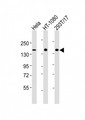 RAPGEF2 Antibody - All lanes : Anti-RAPGEF2 Antibody at 1:2000 dilution Lane 1: HeLa whole cell lysates Lane 2: HT-1080 whole cell lysates Lane 3: 293T/17 whole cell lysates Lysates/proteins at 20 ug per lane. Secondary Goat Anti-Rabbit IgG, (H+L), Peroxidase conjugated at 1/10000 dilution Predicted band size : 167 kDa Blocking/Dilution buffer: 5% NFDM/TBST.