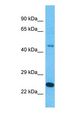 RAPGEFL1 Antibody - Western blot of RAPGEFL1 Antibody with human 721_B Whole Cell lysate.  This image was taken for the unconjugated form of this product. Other forms have not been tested.