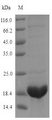 Defensin-like protein 2 Protein - (Tris-Glycine gel) Discontinuous SDS-PAGE (reduced) with 5% enrichment gel and 15% separation gel.