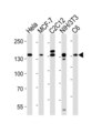 Raptor / Mip1 Antibody - Western blot of lysates from HeLa, MCF-7, mouse C2C12, mouse NIH/3T3, rat C6 cell line (from left to right) with RPTOR Antibody. Antibody was diluted at 1:1000 at each lane. A goat anti-rabbit IgG H&L (HRP) at 1:10000 dilution was used as the secondary antibody. Lysates at 20 ug per lane.