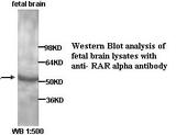 RARA / RAR Alpha Antibody