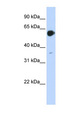 RARA / RAR Alpha Antibody - RARA antibody Western blot of Transfected 293T cell lysate. This image was taken for the unconjugated form of this product. Other forms have not been tested.