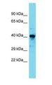 RARA / RAR Alpha Antibody - RARA / RAR Alpha antibody Western Blot of Mouse Kidney. Antibody dilution: 1 ug/ml.  This image was taken for the unconjugated form of this product. Other forms have not been tested.