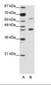 RARA / RAR Alpha Antibody - A: Marker, B: Jurkat Cell Lysate.  This image was taken for the unconjugated form of this product. Other forms have not been tested.