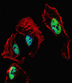 RARB / RAR Beta Antibody - Fluorescent confocal image of HeLa cell stained with RARB Antibody. HeLa cells were fixed with 4% PFA (20 min), permeabilized with Triton X-100 (0.1%, 10 min), then incubated with RARB primary antibody (1:25, 1 h at 37°C). For secondary antibody, Alexa Fluor 488 conjugated donkey anti-rabbit antibody (green) was used (1:400, 50 min at 37°C). Cytoplasmic actin was counterstained with Alexa Fluor 555 (red) conjugated Phalloidin (7units/ml, 1 h at 37°C). Nuclei were counterstained with DAPI (blue) (10 ug/ml, 10 min). RARB immunoreactivity is localized to nucleus significantly.