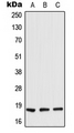 RARRES2 / Chemerin Antibody - Western blot analysis of TIG2 expression in HeLa (A); Raw264.7 (B); rat liver (C) whole cell lysates.