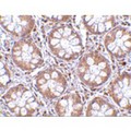 RASD2 Antibody - Immunohistochemistry of TEM2 in human colon tissue with TEM2 antibody at 2.5 µg/mL.