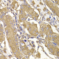 RASGRF1 / CDC25 Antibody - Immunohistochemistry of paraffin-embedded human stomach tissue.