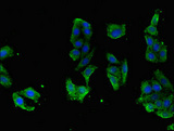 RASGRP1 / RASGRP Antibody - Immunofluorescent analysis of HepG2 cells using RASGRP1 Antibody at dilution of 1:100 and Alexa Fluor 488-congugated AffiniPure Goat Anti-Rabbit IgG(H+L)