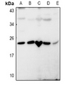 RASL10B Antibody - Western blot analysis of RASL10B expression in A549 (A), LOVO (B), SP20 (C), PMVEC (D), Hela (E) whole cell lysates.