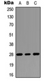 RASSF3 Antibody - Western blot analysis of RASSF3 expression in MCF7 (A); Raw264.7 (B); PC12 (C) whole cell lysates.