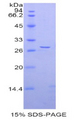 Adam5 Protein - Recombinant A Disintegrin And Metalloprotease 5 By SDS-PAGE