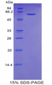 CFB / Complement Factor B Protein - Recombinant Complement Factor B By SDS-PAGE