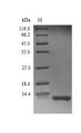 Complement C3 Protein - (Tris-Glycine gel) Discontinuous SDS-PAGE (reduced) with 5% enrichment gel and 15% separation gel.
