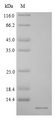 CRYGB Protein - (Tris-Glycine gel) Discontinuous SDS-PAGE (reduced) with 5% enrichment gel and 15% separation gel.