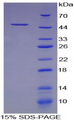CSF2 / GM-CSF Protein - Recombinant Colony Stimulating Factor 2, Granulocyte Macrophage By SDS-PAGE